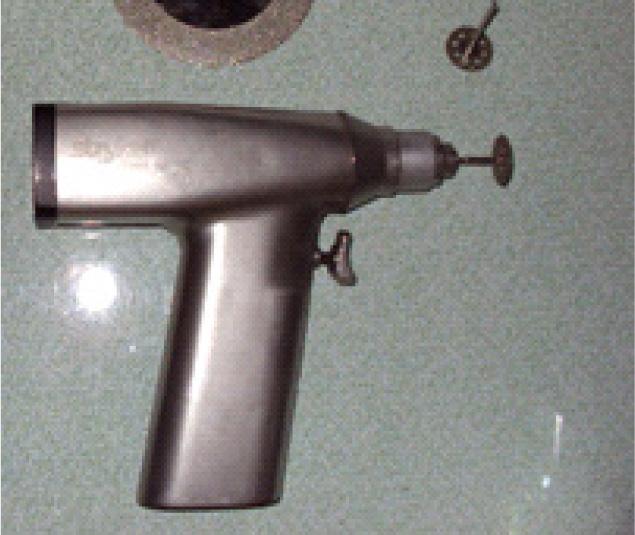 A 30 mm diameter diamond tipped cutting disk mounted in a Stryker drill.