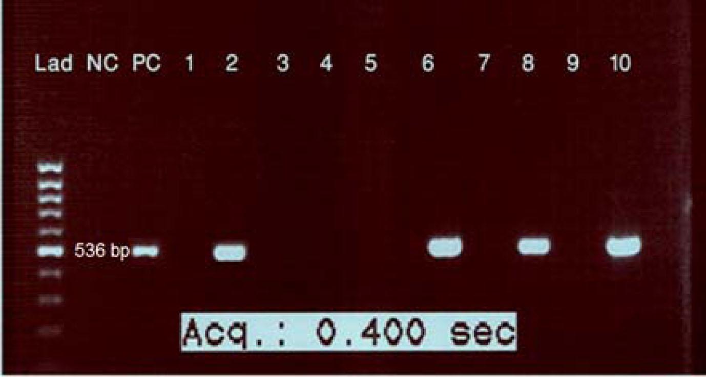 Agarose gel (1.5%) electrophoresis of amplified S segment DNA from the Crimean-Congo hemorrhagic fever virus genome using reverse transcriptase-polymerase chain reaction of RNA in tick samples from Hamadan province. Lad, 100 bp marker ladder; NC, negative control; PC, positive control (536 bp); lanes 2, 6, 8, and 10 positive tick samples