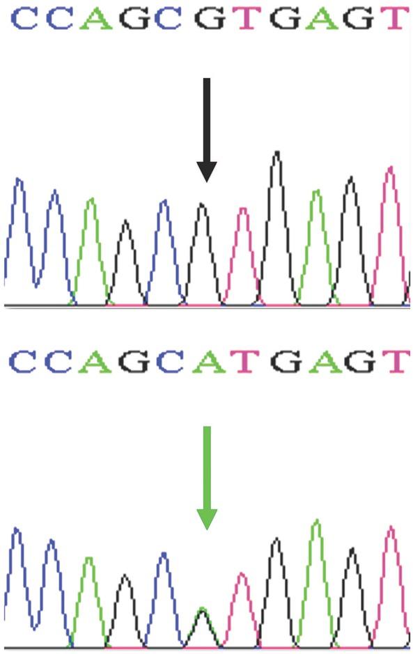 The single nucleotide polymorphism (SNP) G–152A of AGT (rs11568020) by direct sequencing. Electropherograms indicate the polymorphic site of GG (G allele) (black arrow, top) and AG (A allele) (green arrow, bottom) genotypes. No patients with AA genotype were found. C, cytosine blue; A, adenine green; T, thymine magenta; G, guanine black.