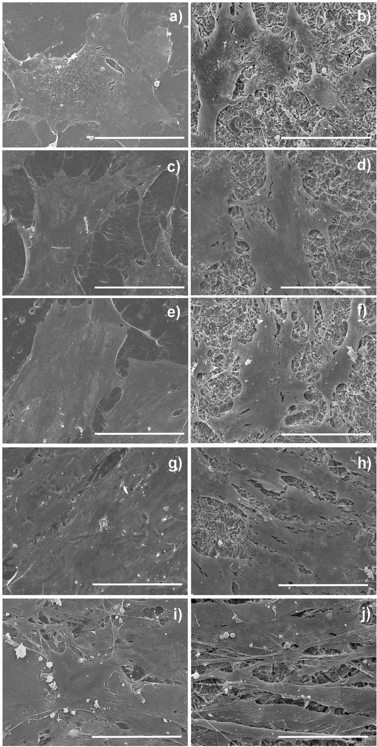 Scanning electron microscopy (SEM) images of osteoblast morphology on uncoated and coated titanium samples. a) uncoated 1 day; b) coated 1 day; c) uncoated 3 days; d) coated 3 days; e) uncoated 7 days; f ) coated 7 days; g) uncoated 14 days; h) coated 14 days; i) uncoated 21 days; and j) coated 21 days (magnification ×1000). Scale bars represent 60 μm