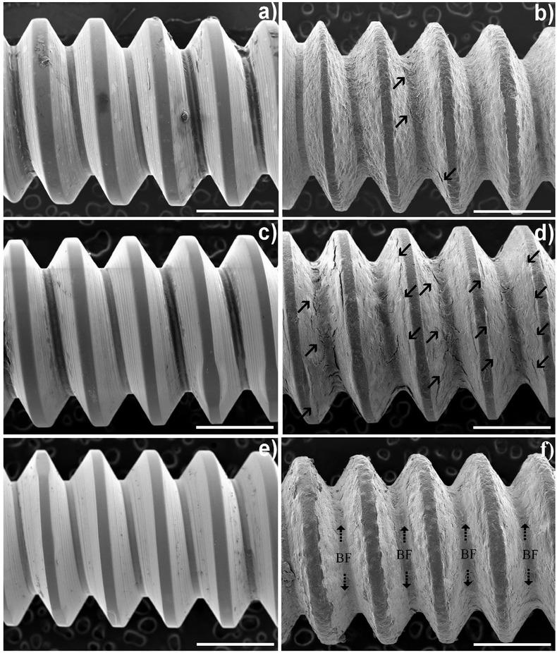 Scanning electron microscopy (SEM) image of uncoated and coated screws extracted from the bone. No detachment of the coating from the underlying screw is noted. Arrows indicate bone fragments (BFs). The amount and size of the BFs increased with increasing implantation periods. a) uncoated 7 weeks; b) coated 7 weeks; c) uncoated 12 weeks; d) coated 12 weeks; e) uncoated 24 weeks; and f ) coated 24 weeks (magnification ×100). Scale bars represent 1 mm