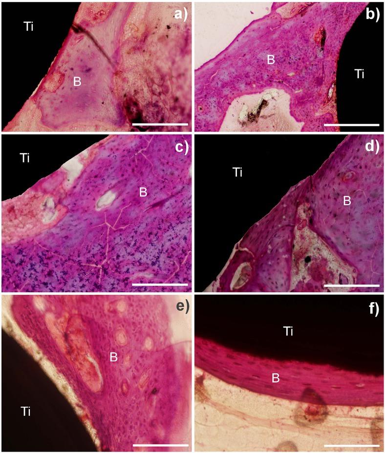 Histology of bone healing around the hydroxyapatite-coated and -uncoated screws in New Zealand white rabbits at 7 weeks, 12 weeks, and 24 weeks after surgery. Hematoxylin and eosin staining demonstrates bone remodeling comprising bone trabeculae with mixed woven bone and lamellar bone. Mature lamellar bone is only observed in coated sample at 24 weeks of implantation. a) uncoated 7 weeks; b) coated 7 weeks; c) uncoated 12 weeks; d) coated 12 weeks; e) uncoated 24 weeks; and f ) coated 24 weeks (magnification ×100; Ti, titanium; B, bone). Scale bars represent 200 μm