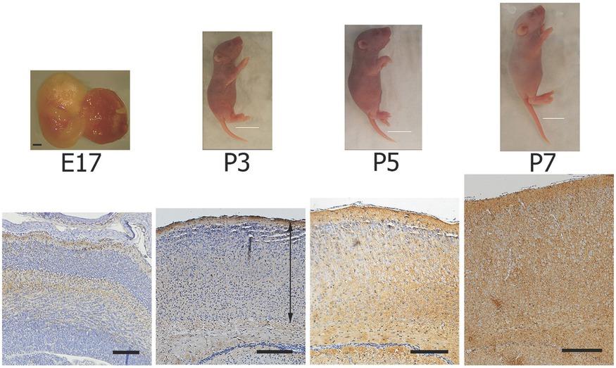 E17 fetal and P3, P5, and P7 postnatal mice with normal appearance. The black scale bar for E17 represents 1 mm. Scale bars in white for the pups represent 1 cm. Neural cell adhesion molecule (NCAM) immunoreactivity (brown) and hematoxylin (purple)-stained coronal brain sections were also compared. Progression of neocortex shows 6 cortical cell layers starting from E17 to P7. At E17, cortical neurons continue to aggregate and separate into layers, but postnatal brains P3, P5, and P7 show the migration of cortical neurons and their location in overlapped layers. NCAM immunoreactivity was increased from E17 to P7. The double-ended arrow indicates the measurement of the cortical thickness. Scale bars on the coronal sections represent 200 μm E17, fetal mouse at embryonic age of 17 days; P3, P5, and P7, postnatal mice 3, 5, and 7 days after birth respectively