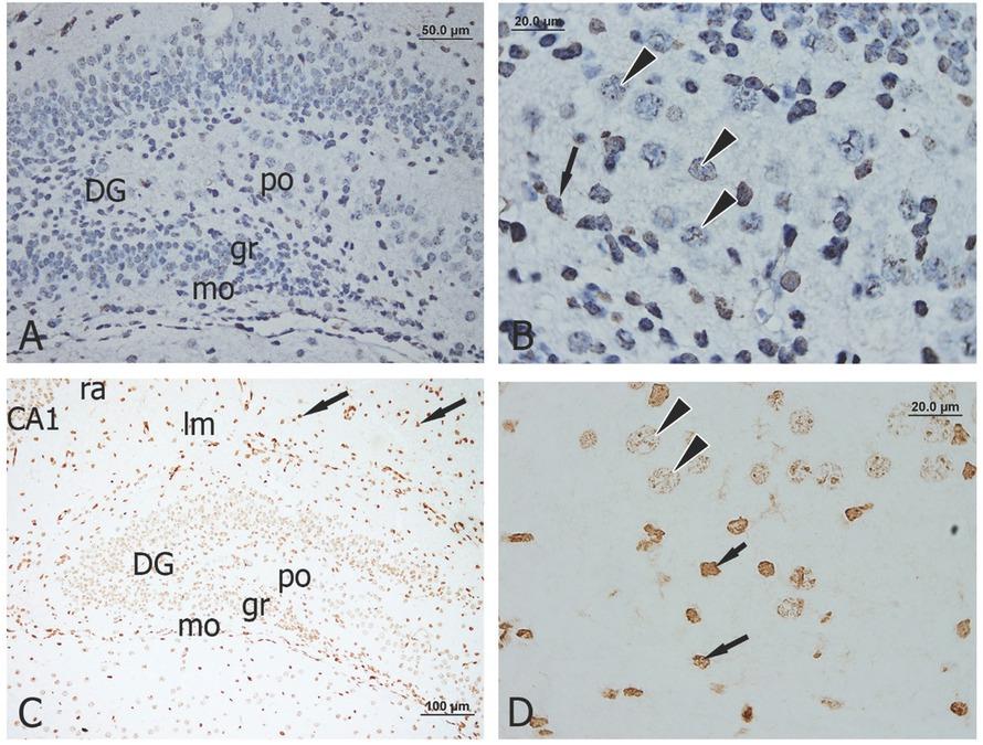 Coronal sections through DG of mice at postnatal day 5 (P5) (A and C) indicating layers in the DG: po layer, strata gr, and mo. PSA–NCAM immunoperoxidase staining with (A and B) or without (C and D) hematoxylin was localized in the cytoplasm and nucleus of neurons in gr (arrow heads) and intense staining in the small nucleus (arrows) is found in lm and ra layers of CA1. Scale bars are 100 μm (C), 50 μm (A), and 20 μm (B, D) CA1, cornu ammonis 1 area of the hippocampus; DG, dentate gyrus; gr, stratum granulosum; lm, stratum lacunosum moleculare; mo, stratum moleculare; NCAM, neural cell adhesion molecule; po, polymorphic layer; PSA, polysialic acid; ra, stratum radiatum