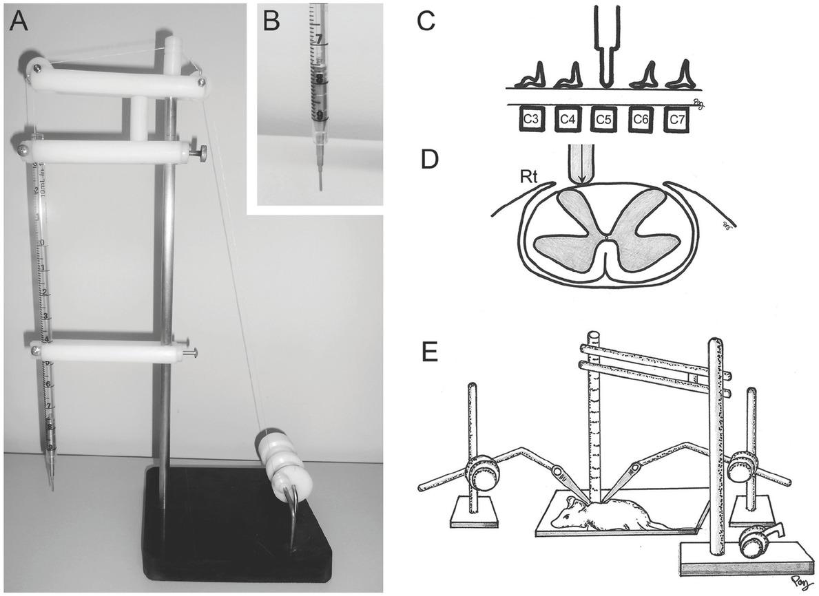 Adapted weight-drop device used to cause hemicontusion spinal cord injury (A, B). The metal rod was applied to the right side (Rt) of the C5 spinal cord (C, D). The spinal column was stabilized by rigidly clamping the vertebral body at C2 and the spinous process of the C7 vertebra with toothed forceps that were connected to supporting arms of an instrument stand (E)