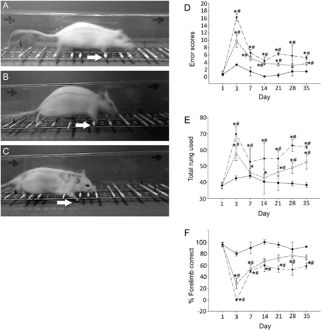 Effect of injury severity on skilled locomotion. The forepaw placement (arrows) is presented as correct placement (A), slip (B), and miss (C). The error scored (D) and the percentage of total rungs used (E) increased significantly on day 3 in rats with MSCI (open circles, dashed lines) and SSCI (inverted solid triangles, dashed and dotted lines). Rats with SSCI showed a significantly higher error and number of rungs used on all days tested compared with rats in the SH group (solid circles, unbroken lines). The percentage of correct forelimb placement (F) by rats with MSCI and SSCI decreased significantly on day 3. Rats with SSCI showed significantly less correct placement than rats with MSCI or SH. *P < 0.05 when compared with day 1. #P < 0.05 compared with rats in the SH group. Error bars indicate standard error of the mean