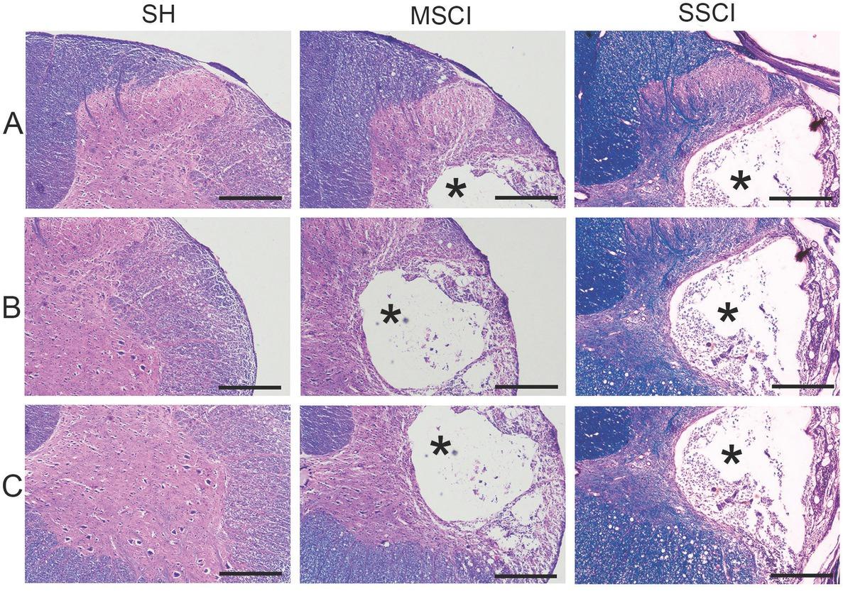 Comparison of histopathological changes demonstrated by Luxol Fast Blue counterstained with hematoxylin and eosin in the rats with sham (laminectomy only) injury (SH), mild spinal cord injury (MSCI), and severe SCI (SSCI). The transverse sections of the spinal cord at C5 showing the dorsal horn (A), white matter (B), and ventral horn (C). MSCI and SSCI showing an intact dura mater and external surface the spinal tissue. The cystic cavity (asterisks) in rats with SSCI was larger than that in rats with MSCI. Scale bars represent 400 μm