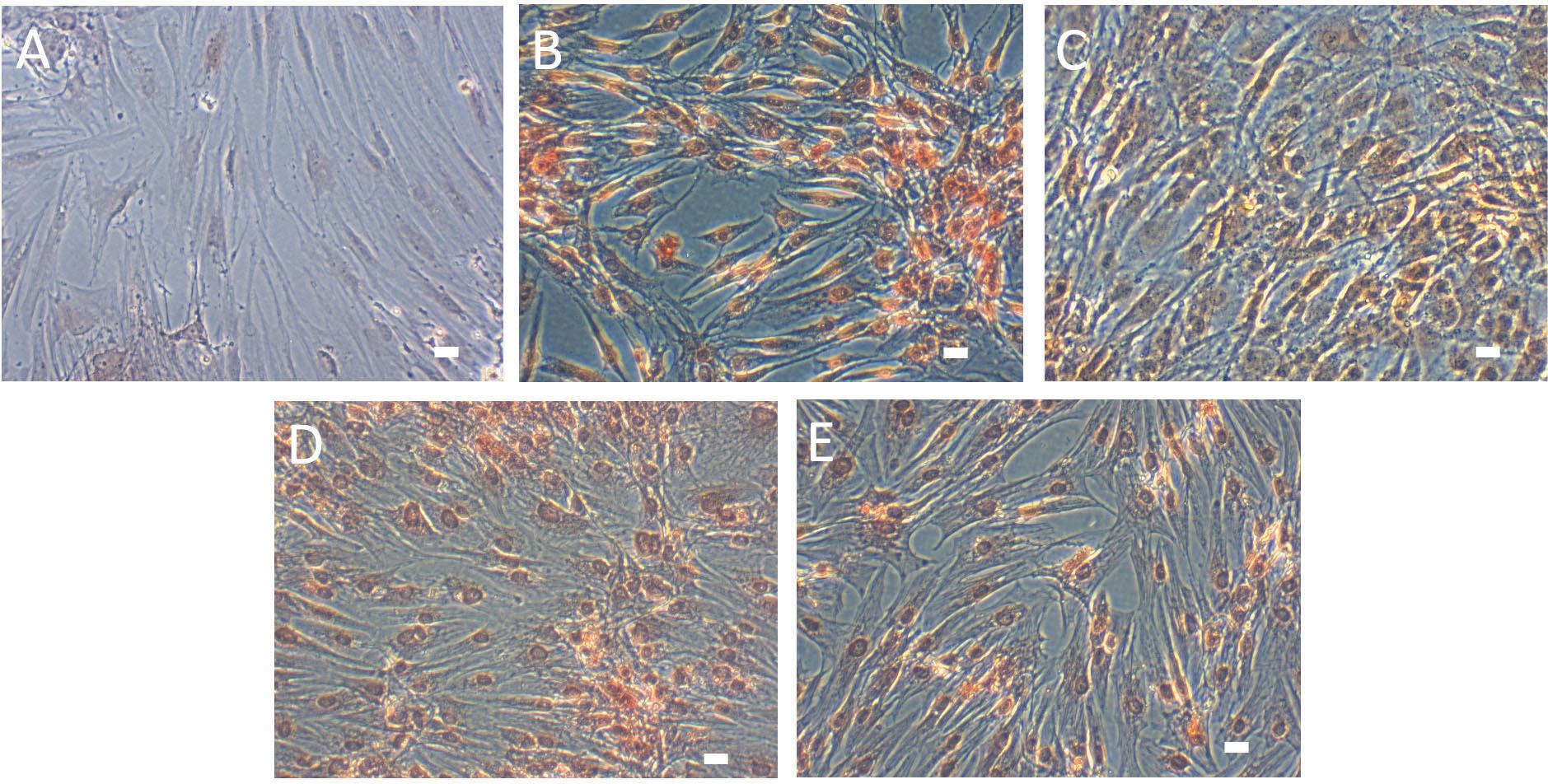 iCCM and chondrocytes showed positive staining for Safranin-O, indicating that the synthesis of the extracellular matrix (GAG) happened as early as day 7. (A) BMSCs, (B) Chondrocytes, (C) iCIM, (D) iCCM 25%, and (E) iCCM 50%. Bars represent 100 μm.