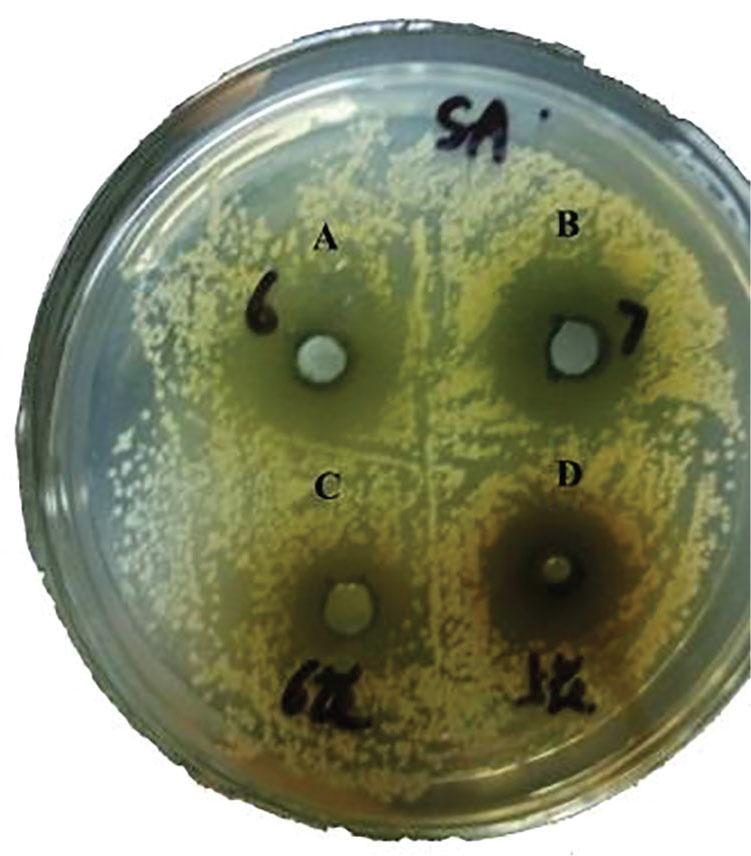The antibacterial effect on Staphylococcus aureus. (A) Leaves (LE) were collected in June, (B) LE were collected in July, (C) green buds (GB), and (D) flowers (FL). The FL and GB were collected in June 2015.
