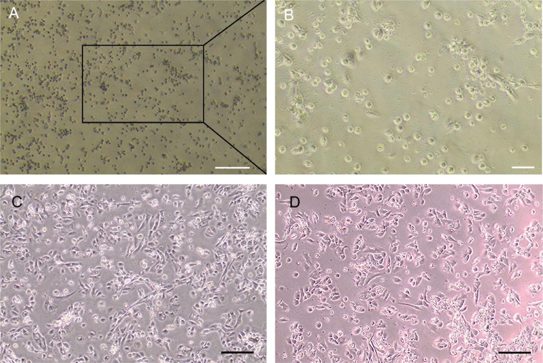 Representative light microscopic images of monolayer human chondrocytes. (A) Passage 0 human chondrocytes isolated with pronase E and collagenase IA seeded at 2.5 × 105 cells per cm2 and visualized at day 2 post-seeding (4× objective lens, scale bar 200 μm) and (B) detail of the insert in the black square as imaged with a 10× objective (scale bar 50μm). (C) Passage 0 chondrocytes at day 10 post-seeding imaged with a 4× objective (scale bar 200 μm). (D) Passage 1 chondrocytes at day 1 post-seeding imaged with a 10× objective (scale bar 200 μm).