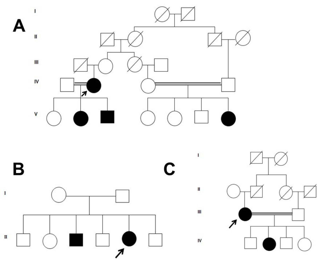 Representative pedigrees of familial cases. (A) Five generation pedigree showing the transmission of polydactyly in 2 independent sibships. In both sibships there were consanguineous marriages. (B) Two generation pedigree showing 2 affected sibs with brachydactyly. (C) Four generation kindred exhibiting the transmission of polydactyly in 2 generations. With informed consent for publication from each participant or with their assent and consent from their husband or a first degree relative.