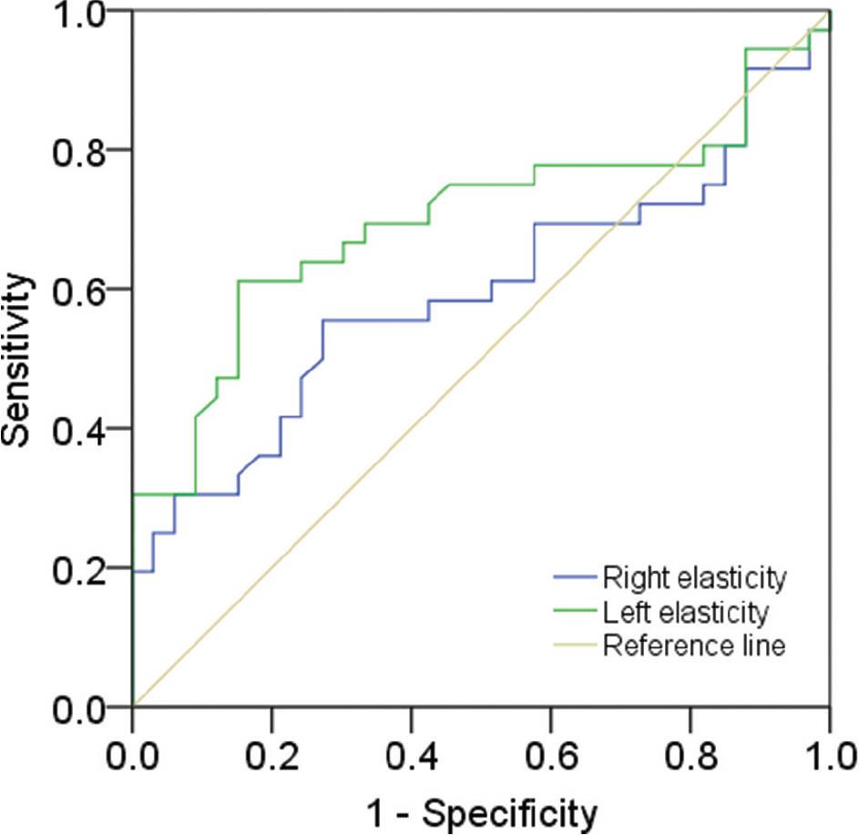 ROC curve of thyroid gland SWE in patients with SCA. The cutoff for the RL elasticity (blue line) is 7.31 kPa (AUC 0.57, P = 0.32), and the cutoff value for the LL elasticity (green line) is 8.06 kPa (AUC 0.68, P = 0.011). Reference line is tan. AUC, area under the curve; LL, left lobe; RL, right lobe; ROC, receiver operating characteristic; SCA, sickle cell anemia; SWE, shear wave elastography.
