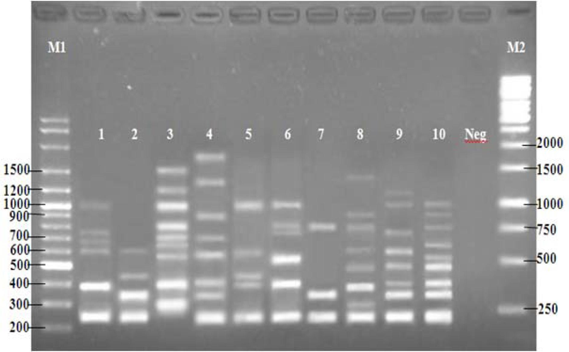 PCR products of dermatophyte species with random primer OPU15. Lanes: M1, 100 bp ladder; 1, Epidermophyton floccosum; 2, Microsporum canis; 3, M. gypseum; 4, M. ferrugineum; 5, Trichophyton mentagrophytes; 6, T. rubrum; 7, T. verrucosum; 8, T. tonsurans; 9, T. violaceum; 10, T. schoenleinii; Neg, no template DNA; M2, 1 kb ladder
