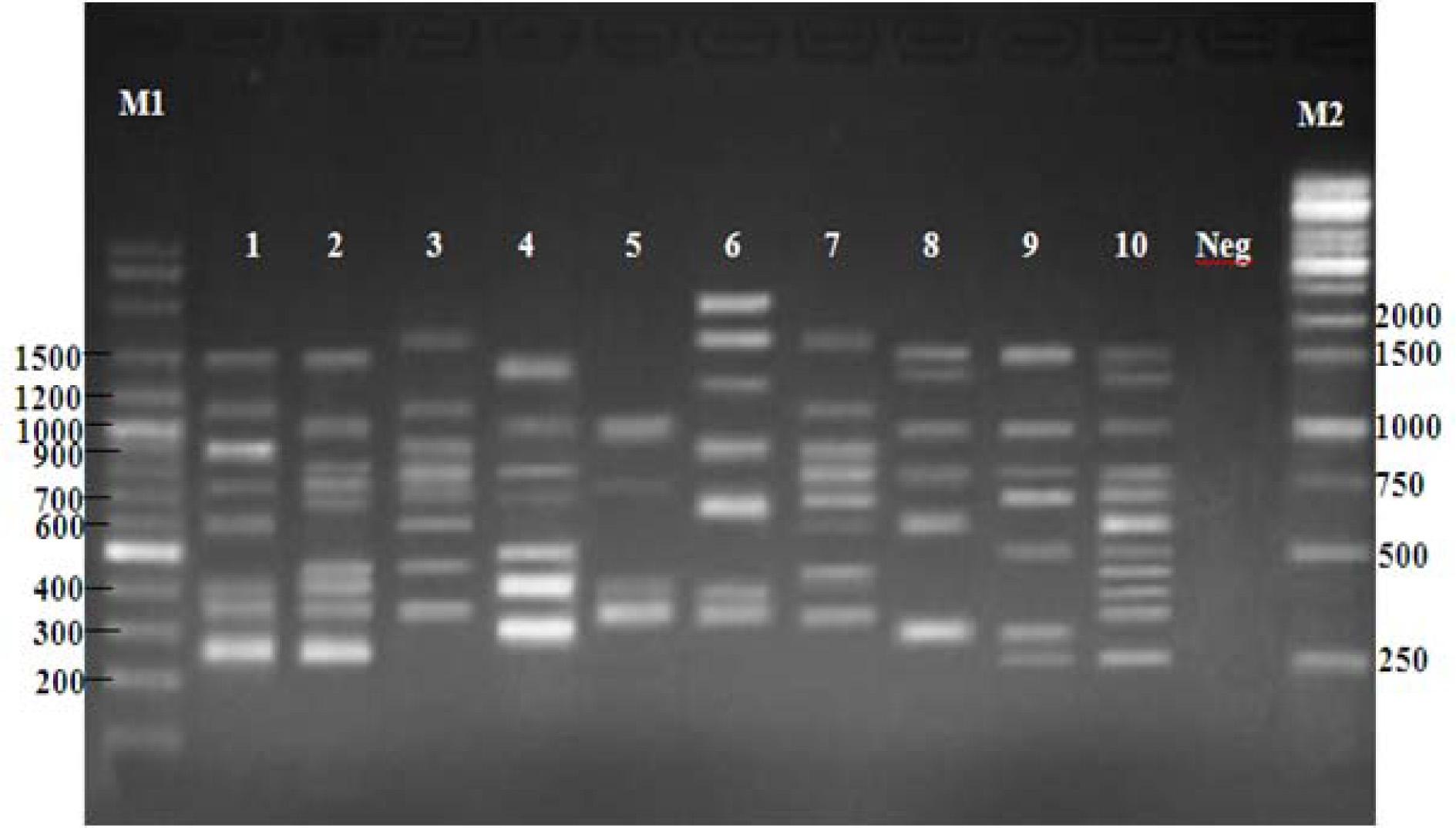 PCR products of dermatophyte species with random primer OPD18. Lanes: M1, 100 bp ladder; 1, Epidermophyton floccosum; 2, Microsporum canis; 3, M. gypseum; 4, M. ferrugineum; 5, Trichophyton mentagrophytes; 6, T. rubrum; 7, T. verrucosum; 8, T. tonsurans; 9, T. violaceum, 10, T. schoenleinii; Neg, no template DNA; M2, 1 kb ladder