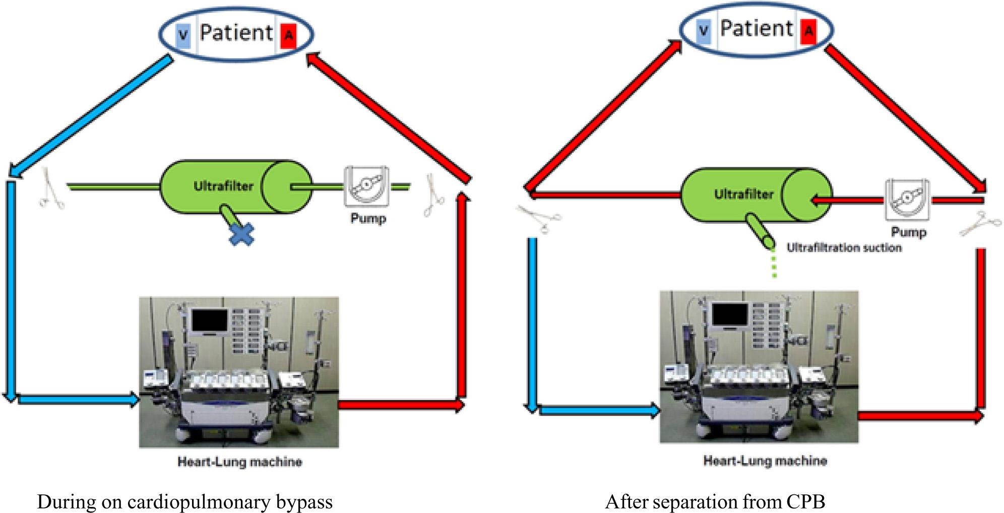 Schematic showing modified ultrafiltration