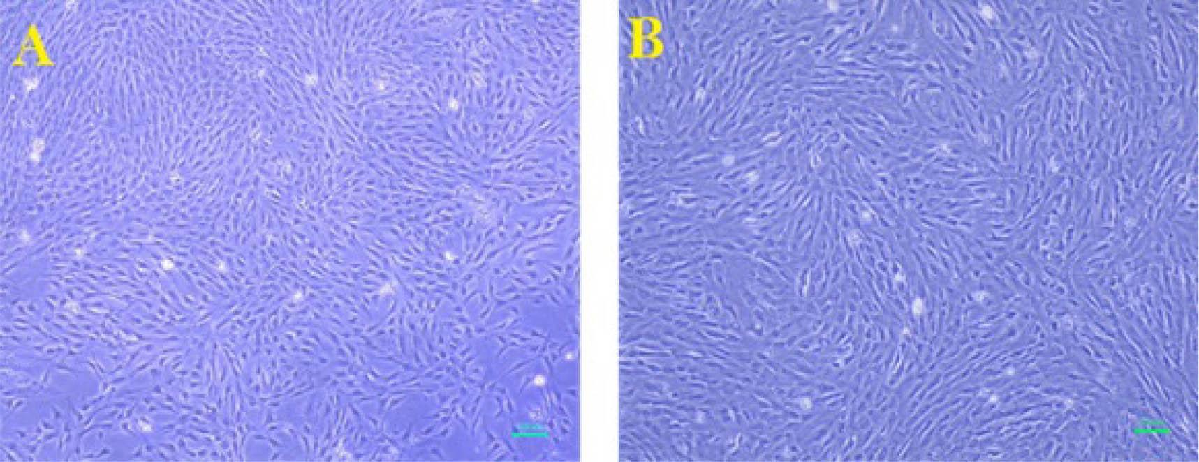 The Morphology of Wharton's Jelly-Derived MesenchymalStem Cells at (A) Primary Culture and (B) 3rd Passage