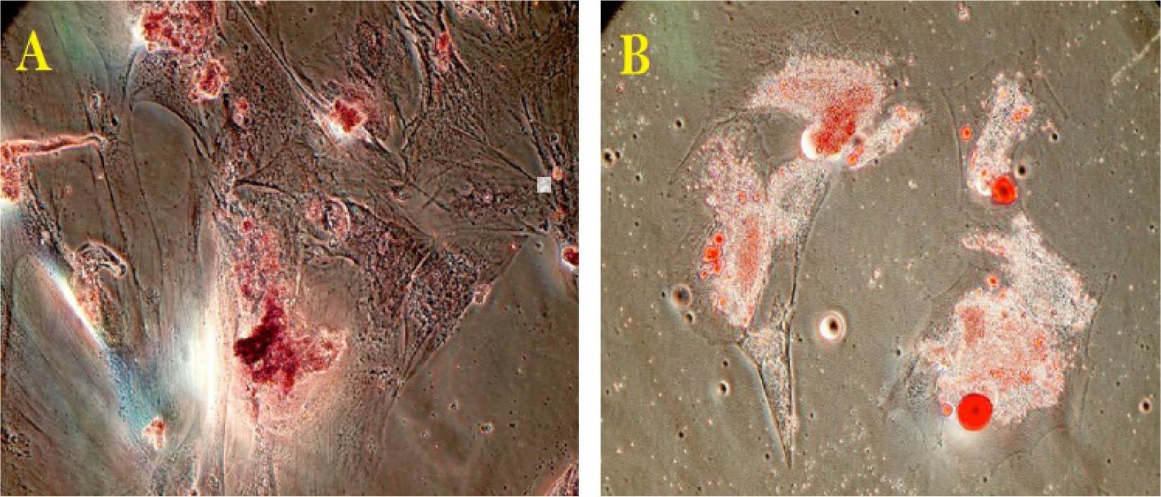 Osteogenic differentiation was confirmed by staining of Calcium deposits with Alizarin Red/S (A). Oil Red showed the presence of lipid droplets in the cells cultured in adipogenic medium (B). Magnification: 400 X
