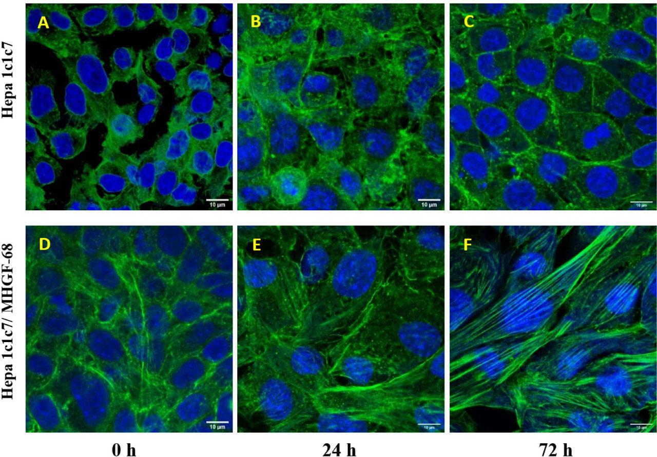 Distribution of actin filaments in Hepa1c1c7 cells incubated with MHGF-68 after dynamic cultivation.Hepa1c1c7 cells were incubated with MHGF-68. After 0, 24 and 72 h, the cells were fixed and labeled with Alexa Fluor 555 phalloidin. Nuclei were stained with DAPI. The intracelular distribution of actin filamets (green) and nuclei (blue) were imaged by confocal laser scanning fluorescence microscopy (Leica TCS SP8 AOBS) with HC PL APO CS2 63×/1.40 OIL lens.A Hepa1c1c7 untreated, 0 h cultivation B Hepa1c1c7 untreated, 24 h cultivation C Hepa1c1c7 untreated, 72 h cultivation D Hepa1c1c7 + MHGF-68, 0 h cultivation E Hepa1c1c7 + MHGF-68, 24 h cultivation F Hepa1c1c7 + MHGF-68, 72 h cultivation