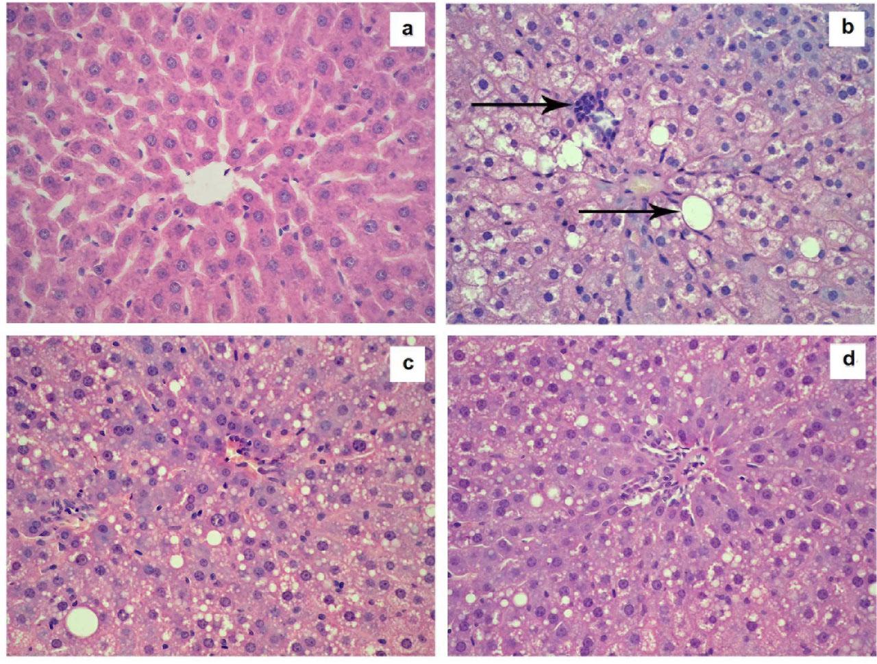 Histological evaluation of the liver of rats with alcoholic steatohepatitis without or after the red cabbage extract (RCE) treatment. (a) Control; (b) Alcohol-treated group (ASH); (c) ASH + RCE (11 mg/kg), (d) ASH + RCE (22 mg/kg). Representative microphotographs of liver sections. The control group displayed normal liver architecture. The group administered with ethanol alone showed macro- and microvesicular liver steatosis, ballooning vacuolisation, scattered lymphocytic infiltration of portal tracts, and inflammatory foci. Macrovesicular fatty dystrophy and inflammatory foci were shown in the ASH group (black arrows). The signs of liver damage, degeneration, and inflammation were substantially reduced with the RCE treatment. The group treated with the larger dose of RCE was characterised mainly by microvesicular steatosis and scattered lymphoid infiltration. Rat liver sections were stained with Haematoxylin and Eosin (magnification: ocular 10×, objective 40×).