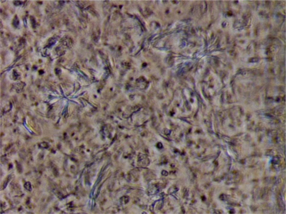 Microscopic observation of 3% soy lecithin + 3% STS + fucoidan + LMWCS in olive oil, magnification 400×.