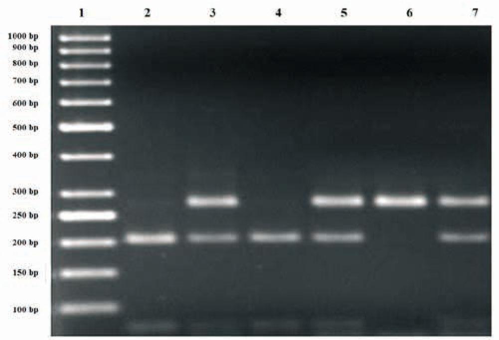Analysis of the genotype polymorphism MTHFD1 c.1958G>A after hydrolysis with restriction enzyme MspI; lane 1 - marker, lanes 3, 5, 7 - heterozygote GA, lanes 2, 4 - homozygous GG, lane 6 is homozygous AA