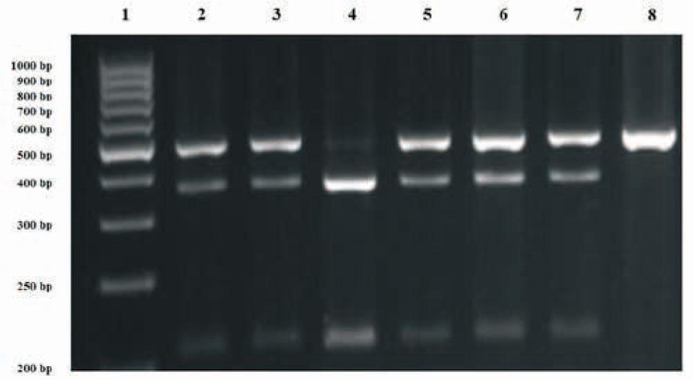 Analysis of genotype polymorphism TCN2 c.776G>C after hydrolysis with restriction enzyme ScrFI; lane 1 - marker; lanes 2, 3, 5, 6, 7 - heterozygous CG, lane 4 - homozygous CC, lane 8 is homozygous GG