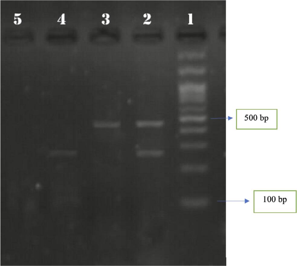 The multiplex PCR assay’s specificity was examined using PCR mixes containing all two-primer pairs and a single template (cDNA/DNA) from the positive controls. Lane 1: standard 100-bp DNA ladder marker. Lane 2: the mixture of enterovirus (440 bp) and HSV (292 bp) positive controls. Lane 3: enterovirus (440 bp), Lane 4: HSV (292 bp), Lane 5: negative control (E. coli)