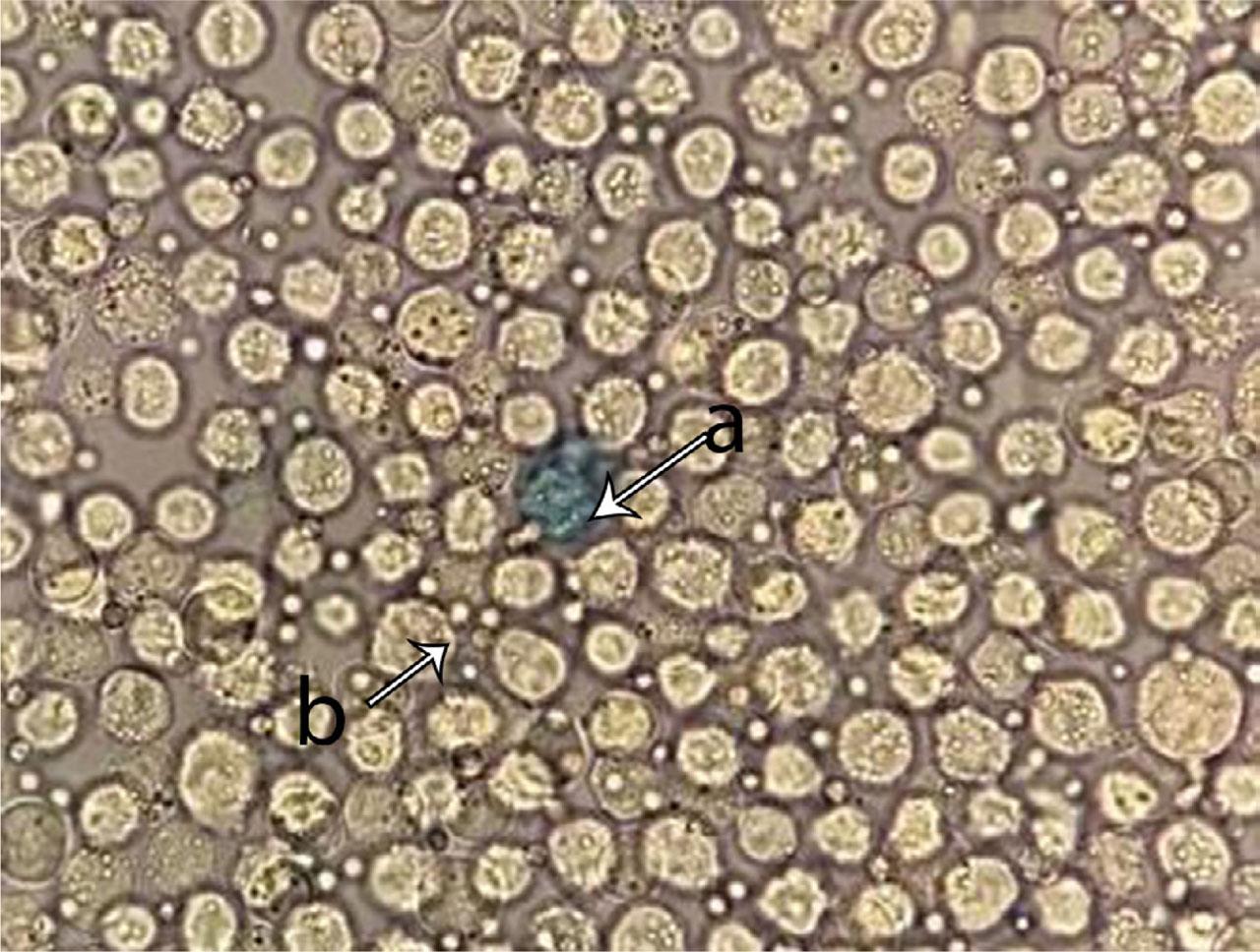 EAT cells view under light microscope a:Dead EAT cell b:Live EAT cell (X40)