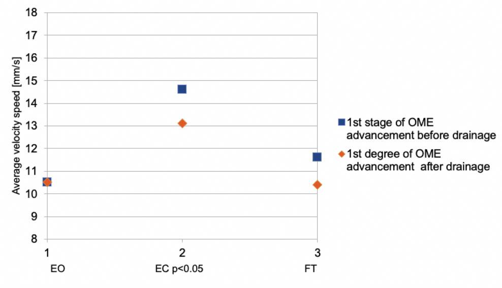 Stabilogram parameters for AVS for subgroup with 1st stage of advancement before and after middle ear drainage