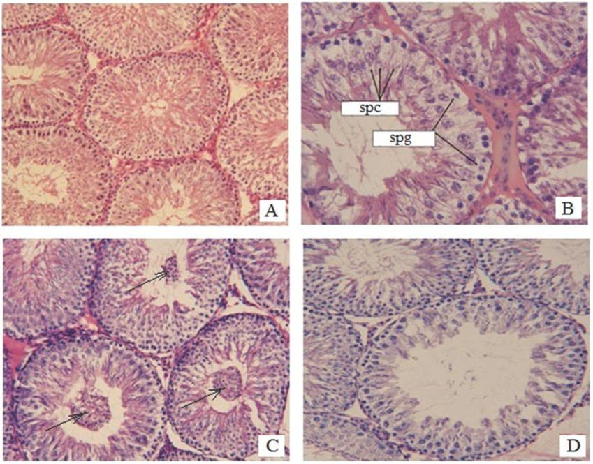 Photomicrographs of rat testes stained with haematoxylin and eosin; (A) normal structure of seminiferous tubules in control rats (200x magnification); (B) focal dystrophic changes in spermatogonia (spg) and primary spermatocytes (spc) in HF rats (400x magnification); (C) spermatogenic epithelium exfoliation into the lumens of seminiferous tubules in HF rats (200x magnification); (D) decrease in the number of spermatogenic epithelium layers and expansion of the seminiferous tubules in HF rats (400x magnification)