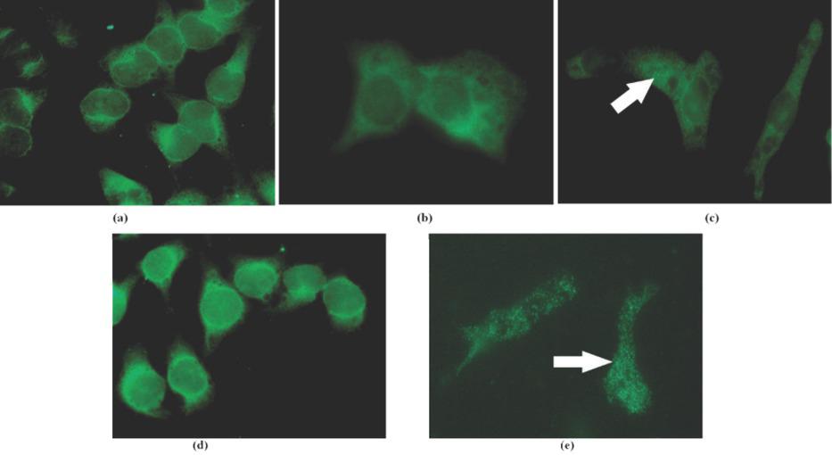 Photomicrography of microtubule cellular structure (400x magnification) in V79 cells after 1-hour (a), 2-hour (b), and 3-hour (c) GSM-modulated 915 MHz radiation exposure with the corresponding SAR 1.6 W/kg, including negative (d), and positive control (e). Microtubular structure impairment, visible as grainy fluorescent clusters, is indicated by arrows