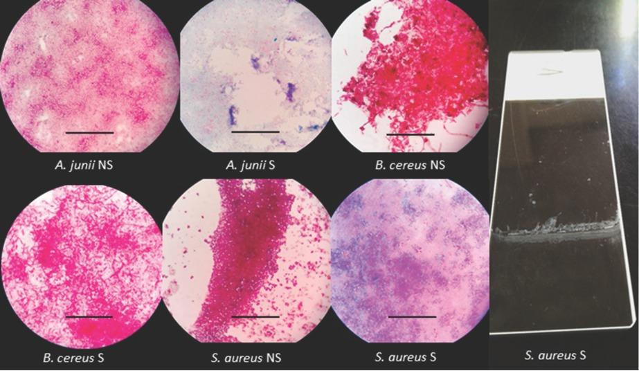 Biofilms grown on glass microscopy slides at the air/liquid interface after 7 days of incubation. Far right: macroscopic view of biofilm formed at air/liquid interface. NS – experiments without shaking; S – experiments with shaking. Scale bar=50 μm