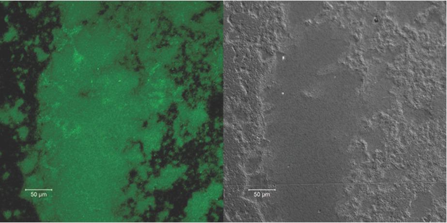 Biofilm of P. aeruginosa at the air/liquid interface after 7 days of incubation under confocal microscopy. Left: autoflorescence; Right: bright field. Scale bar=50 μm