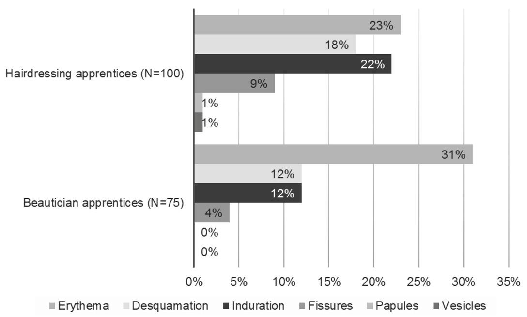 Skin symptoms found during clinical examination of hands/wrists. One apprentice from each group did not complete skin examination. There was no significant statistical difference in proportions of each symptom between the hairdressing and beautician apprentices