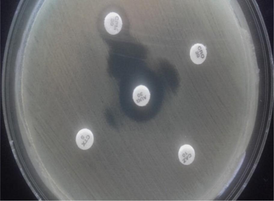 Phenotypic detection of ESBL producers with DDST. The elliptical inhibitory zone between cephalosporins and clavulanic acid (augmentin) indicates an ESBL-producing organism. AUG – augmentin; CAZ – ceftazidime; CPM – cefepime; CRO – ceftriaxone; CTX – cefotaxime