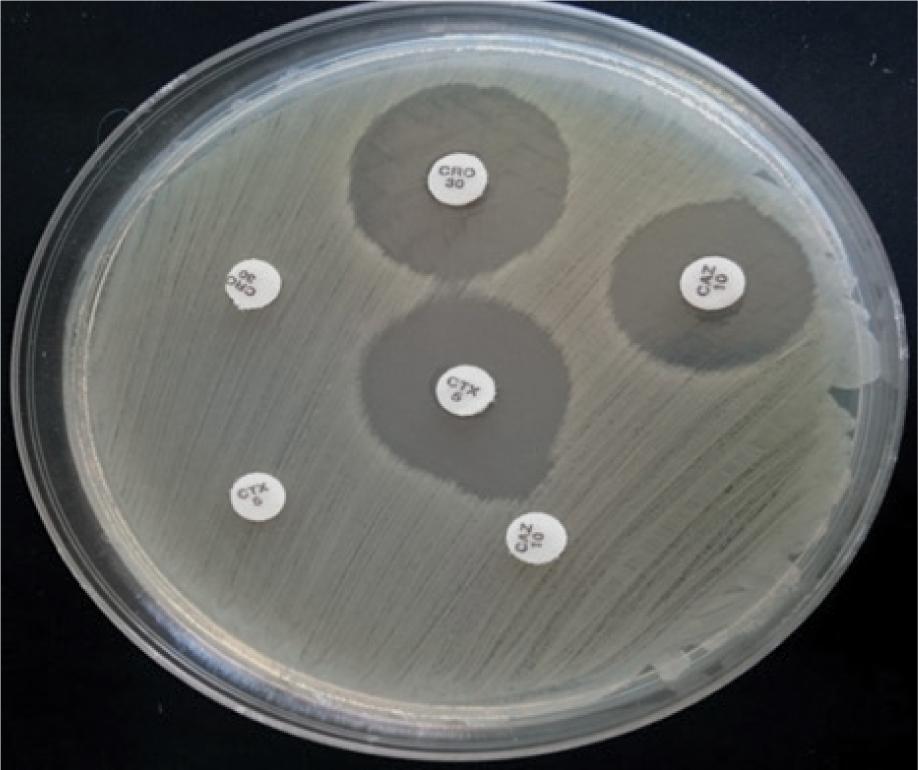 Phenotypic detection of ESBL-producing organisms with the combined disk test. Positive results are those with visible inhibition zones (>5 mm in diameter) around CAZ, CTX, and CRO disks in combination with clavulanate vs those without clavulanate. CAZ – ceftazidime; CRO – ceftriaxone; CTX – cefotaxime