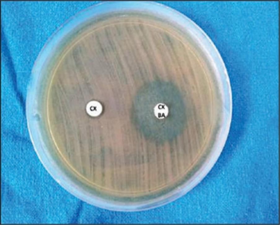 Combined disk test for the detection of plasmid-mediated AmpC β-lactamases with the cefotaxime disk alone (left) and in combination with 3-aminophenylboronic acid (right)