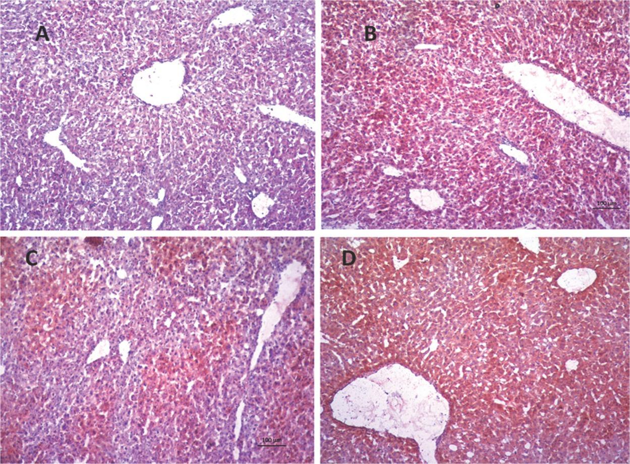 Lipid steatosis stained with Oil Red in the liver of control mice (A) and mice treated with daily doses of 150 mg/kg bw valproate (B), 25 mg/ kg bw naringin (C), and their combination (D) for 10 days
