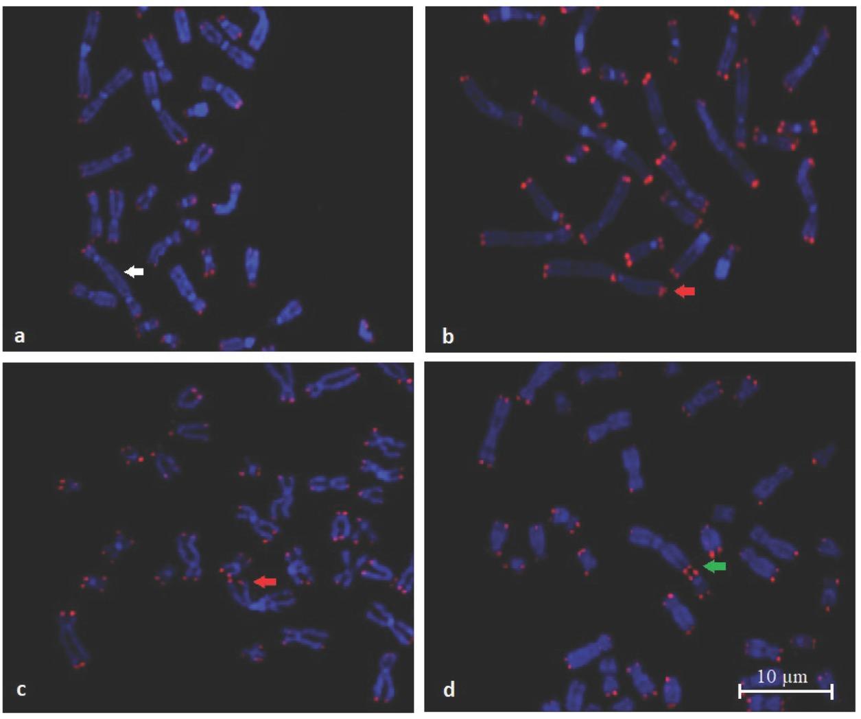 Representative photomicrographs of fragile telomeres (Q-FISH). White arrow indicates a dicentric chromosome without telomere signal (a). Red arrow indicates fragile telomeres (b, c). Green arrow indicates telomere fusion between two chromosomes (d)