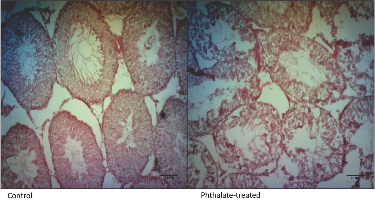 Comparison of luminal area cryosections of testes stained with Gill’s haematoxylin and eosin between a control and a phthalate-treated male rat