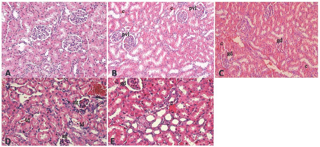 Kidney tissue photomicrographs in A – the oil control group (×400 magnification); B – the group receiving MEHP dose of 100 mg/kg bw a day (×200 magnification); C – the group receiving MEHP dose of 200 mg/kg bw a day (×200 magnification); D – the group receiving MBP dose of 200 mg/kg bw a day (×400 magnification); E – the group receiving MBP dose of 400 mg/kg bw a day (×400 magnification). ag – athropic glomerulus; c – congestion; gd – glomerular degeneration; pvl – parietal and visceral leaves; td – tubular degeneration