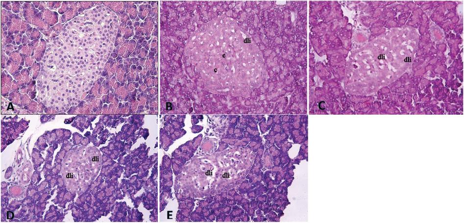 Pancreas tissue photomicrographs in A – the oil control group (×400 magnification); B – the group receiving MEHP dose of 200 mg/kg bw a day (×400 magnification); C – the group receiving MEHP dose of 400 mg/kg bw a day (×400 magnification); D – the group receiving MBP dose of 200 mg/kg bw a day (×200 magnification); E – the group receiving MBP dose of 400 mg/kg bw a day (×200 magnification). c – congestion; dli – degeneration of Langerhans islets