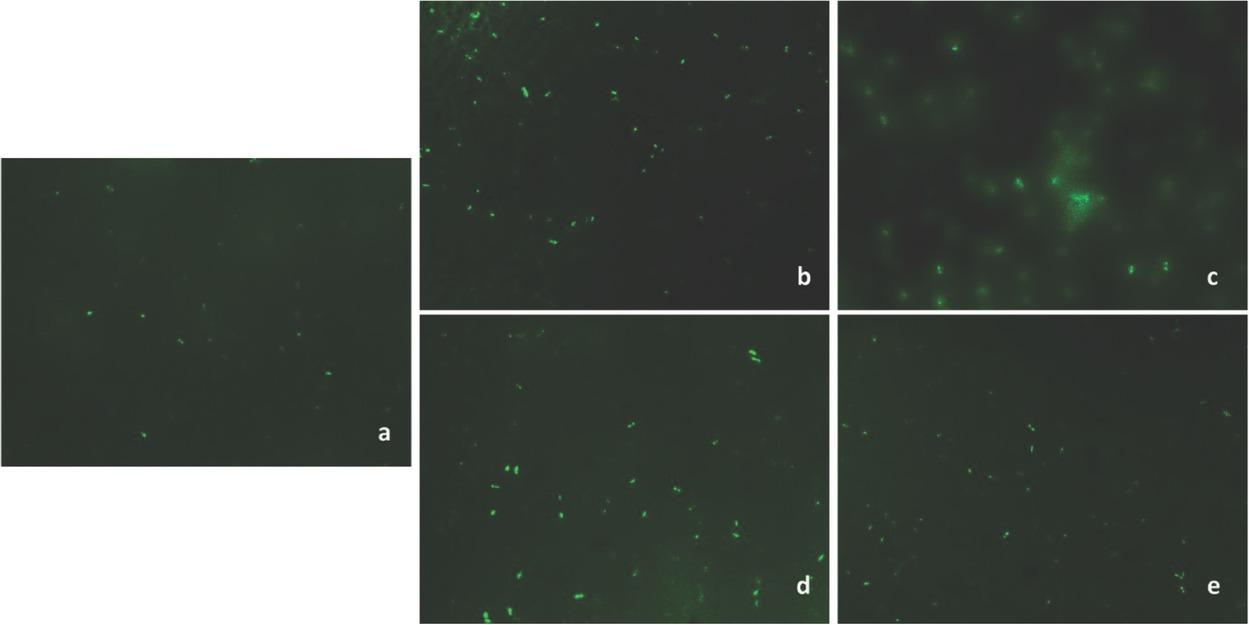 Photomicrographs show bacterial uptake of formulations (a: fluorescein solution; b: SLN1; c: SLN2; d: NLC1; e: NLC2)(40× magnification)