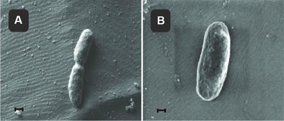 B. holmesii ATCC 51541(A) szerokość pola widzenia FOV 2,8 µm, powiększenie 100 000x, wskaźnik skali 200 nm, detektor Everhard – Thornley (B) szerokość pola widzenia FOV 2,0 µm, powiększenie 150 000x, wskaźnik skali 100 nm, detektor InLens SE1; fot. dr hab. Marek Drab.