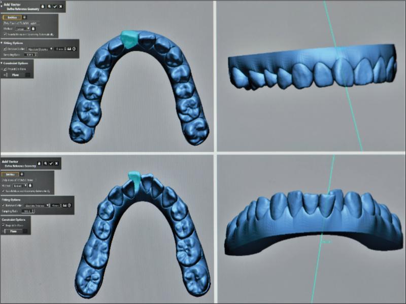 Generation of long axis of the tooth.