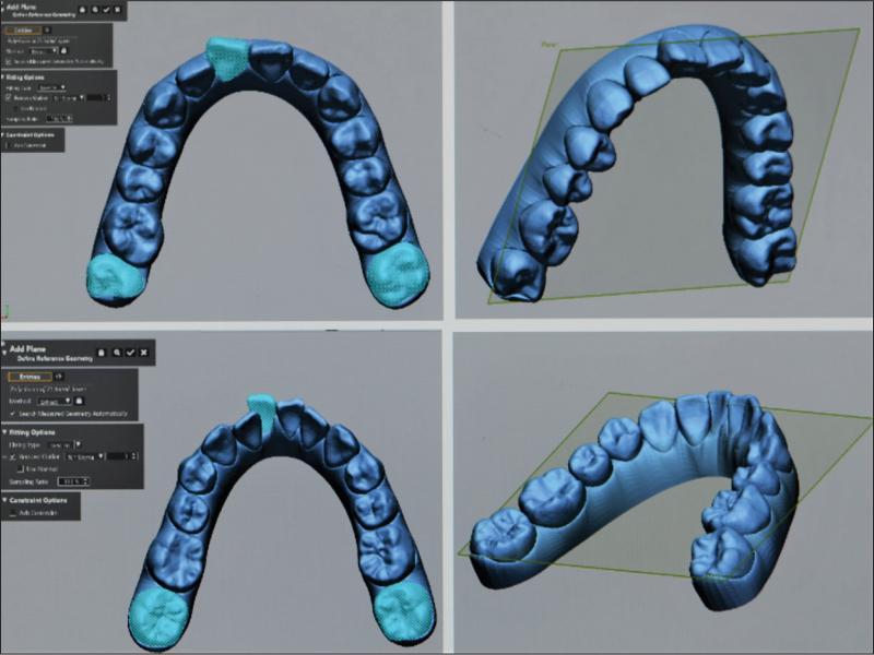Generation of reference plane.