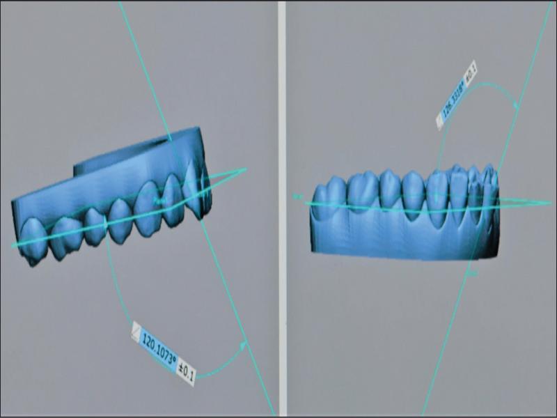 Measurement of torque.