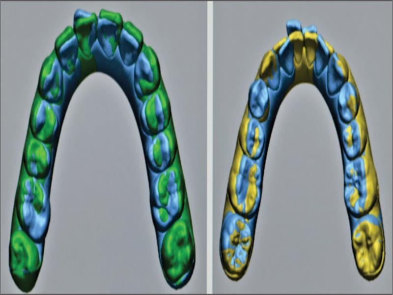 Best-fit superimposition (global and fine).