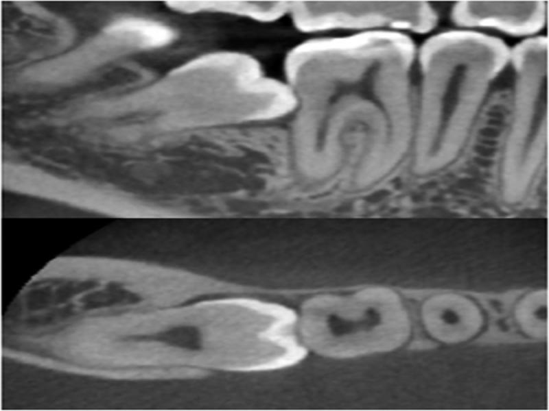 Three-dimensional computed tomography (3DCT) images.