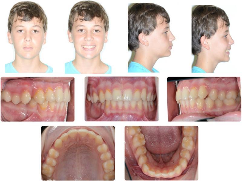 Pre-treatment photographs.